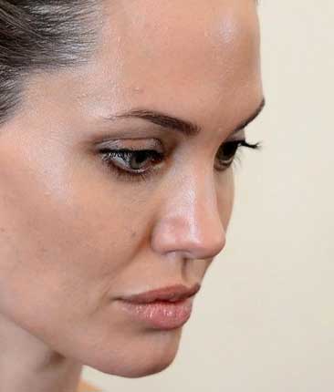 Профиль Джоли - угол нижней челюсти + овал лица + подбородок   в салоне красоты на Проспекте Вернадского